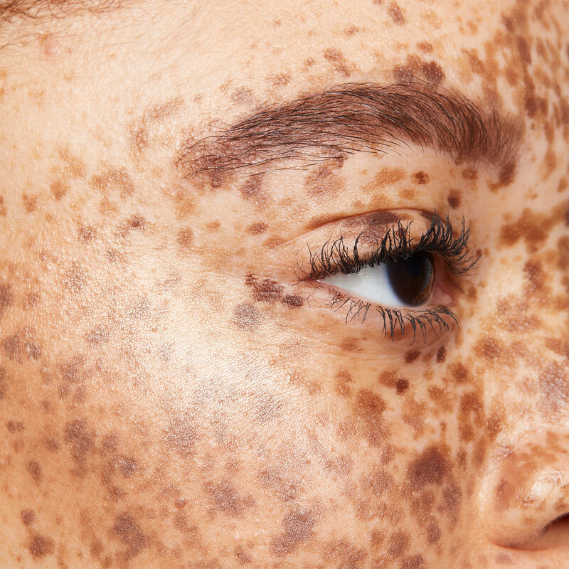 Nahaufnahme mittlere Hautfarbe mit r&ouml;tlich-braunen Haaren, Sommersprossen und Bronzer.