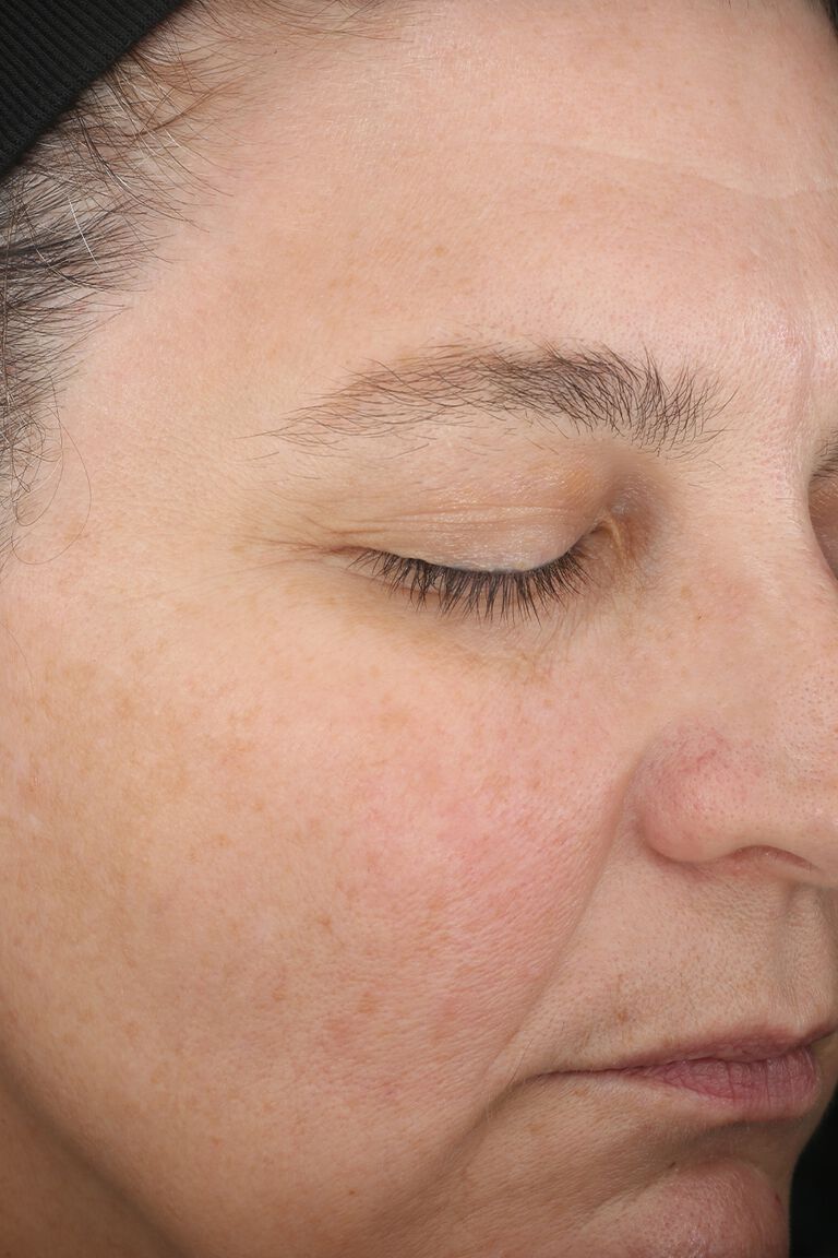 Nahaufnahme der Haut im Gesicht: Eine Frau mit geschlossenen Augen vor der Anwendung des Mary Kay TimeWise "Wunder-Set"