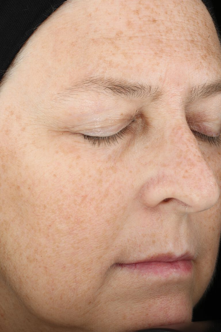 Nahaufnahme der Haut im Gesicht: Eine Frau mit geschlossenen Augen vor der Anwendung des Mary Kay TimeWise "Wunder-Set"