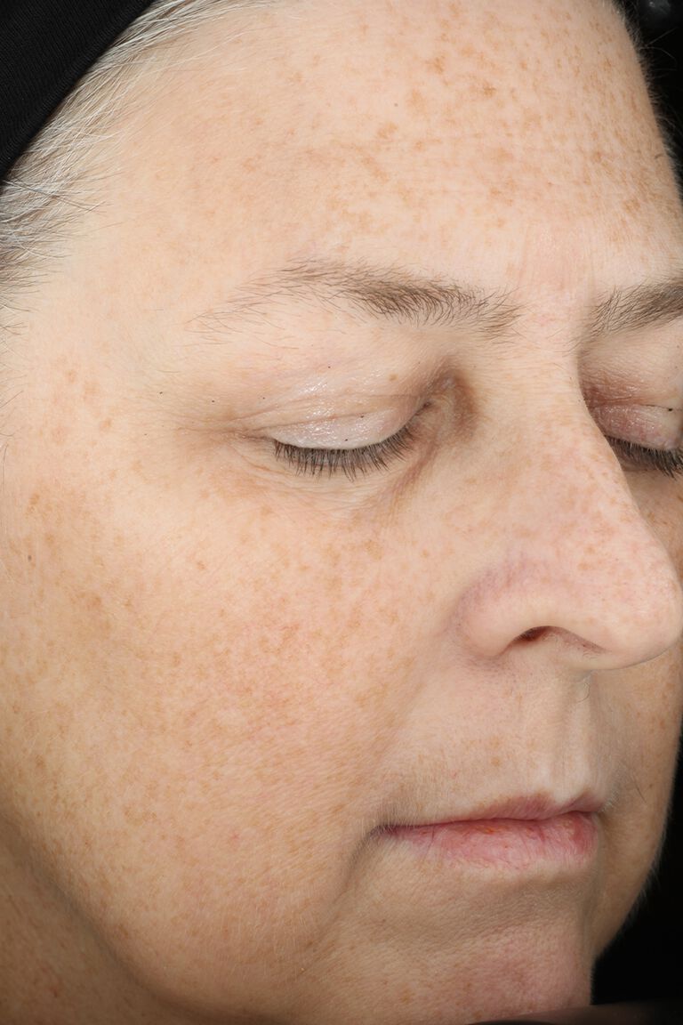 Nahaufnahme der Haut im Gesicht: Eine Frau mit geschlossenen Augen nach der Anwendung des Mary Kay TimeWise "Wunder-Set" (nach 12 Wochen)